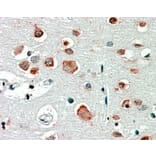 Immunohistochemistry - Anti-GABRA4 Antibody (A84624) - Antibodies.com