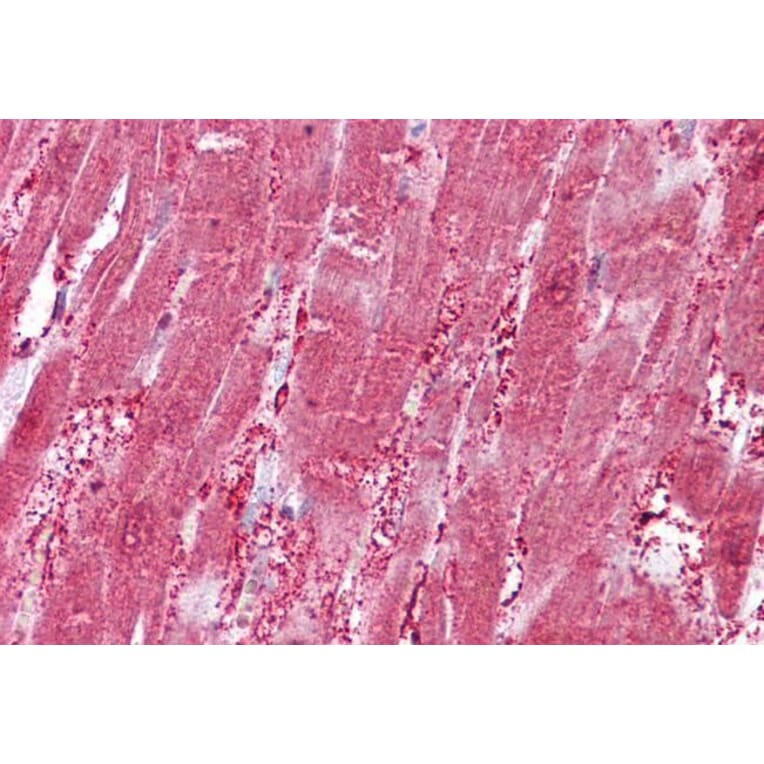 Immunohistochemistry - Anti-CSRP3 Antibody (A84625) - Antibodies.com