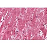 Immunohistochemistry - Anti-CSRP3 Antibody (A84625) - Antibodies.com