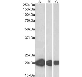 Western Blot - Anti-CSRP3 Antibody (A84625) - Antibodies.com
