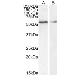 Western Blot - Anti-Desmin Antibody (A84626) - Antibodies.com