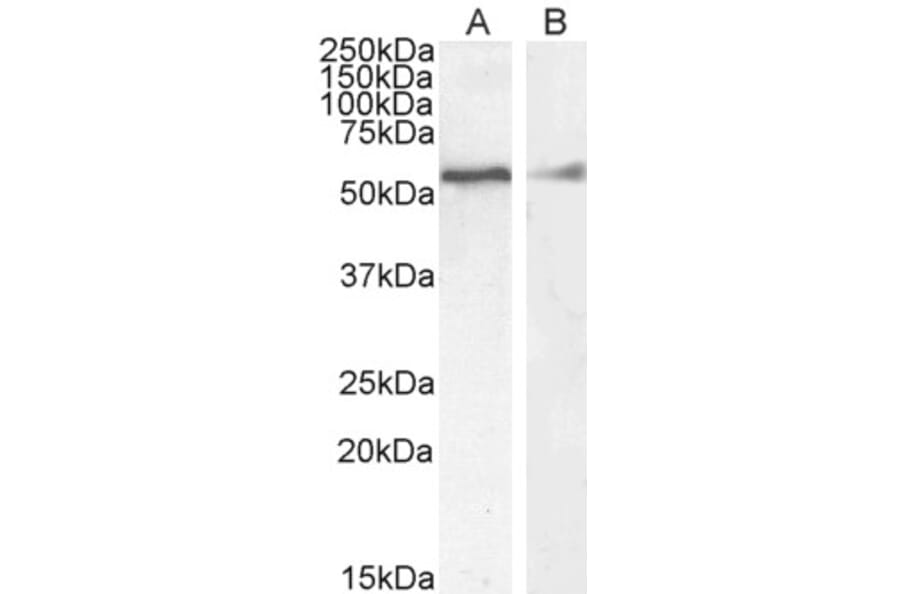 Western Blot - Anti-Desmin Antibody (A84626) - Antibodies.com