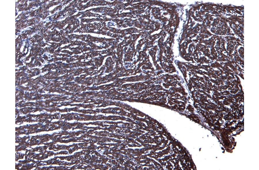 Immunohistochemistry - Anti-Desmin Antibody (A84626) - Antibodies.com