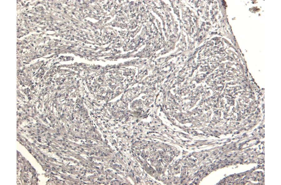 Immunohistochemistry - Anti-Desmin Antibody (A84626) - Antibodies.com