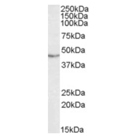 Western Blot - Anti-TDP43 Antibody (A84627) - Antibodies.com