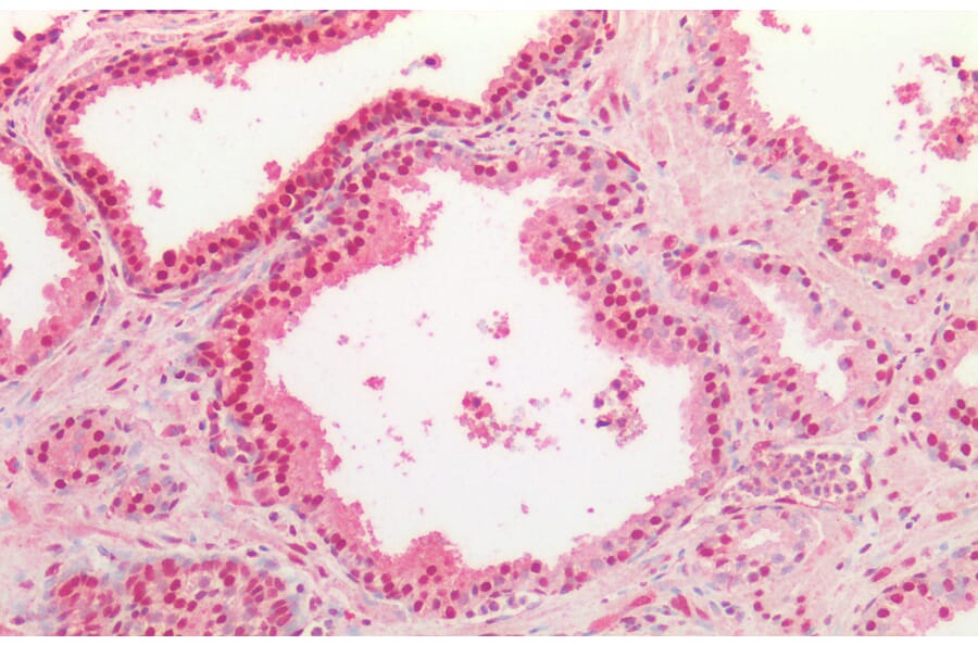Immunohistochemistry - Anti-TDP43 Antibody (A84627) - Antibodies.com