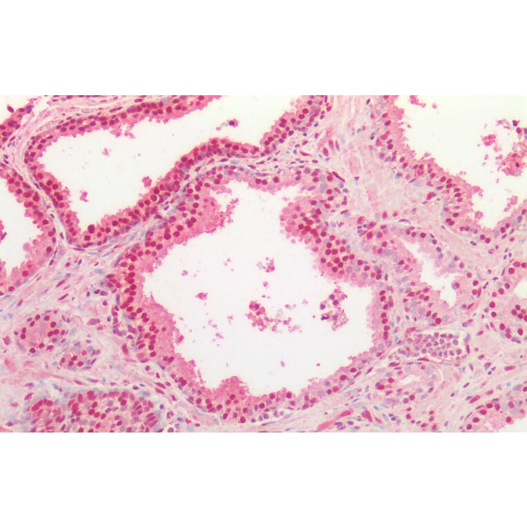 Immunohistochemistry - Anti-TDP43 Antibody (A84627) - Antibodies.com