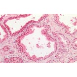 Immunohistochemistry - Anti-TDP43 Antibody (A84627) - Antibodies.com