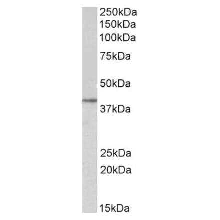 Western Blot - Anti-SFRP4 Antibody (A84629) - Antibodies.com