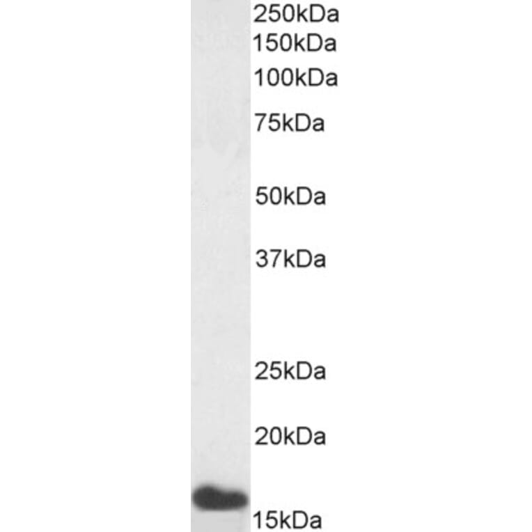 Western Blot - Anti-Noxa Antibody (A84630) - Antibodies.com