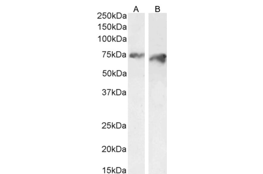 Western Blot - Anti-PCSK9 Antibody (A84632) - Antibodies.com