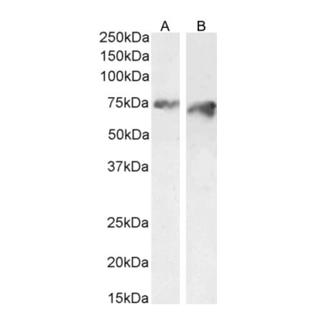 Western Blot - Anti-PCSK9 Antibody (A84632) - Antibodies.com