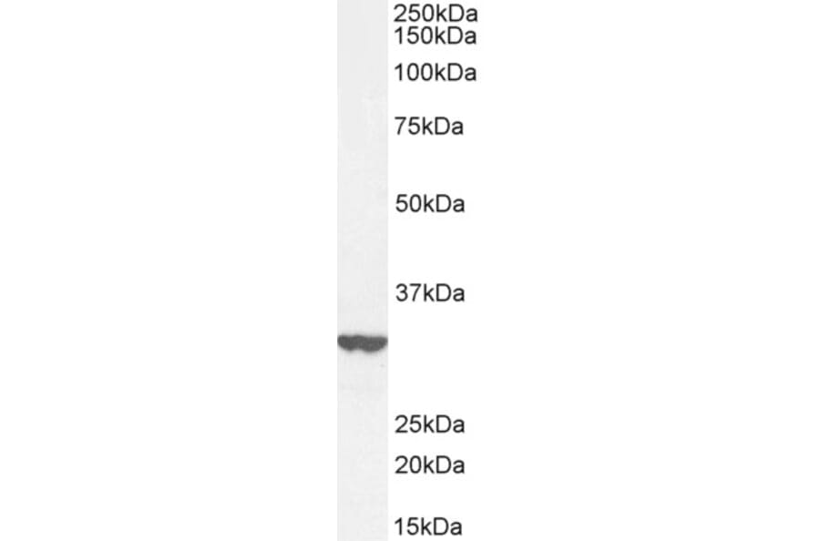 Western Blot - Anti-ITM2B Antibody (A84634) - Antibodies.com