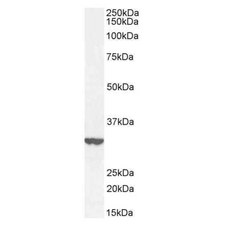 Western Blot - Anti-ITM2B Antibody (A84634) - Antibodies.com