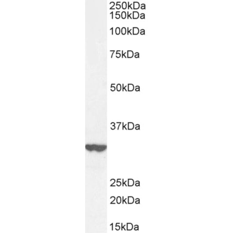 Western Blot - Anti-ITM2B Antibody (A84634) - Antibodies.com