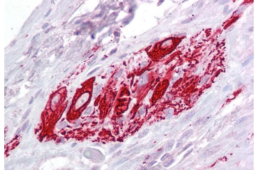 Immunohistochemistry - Anti-ITM2B Antibody (A84634) - Antibodies.com