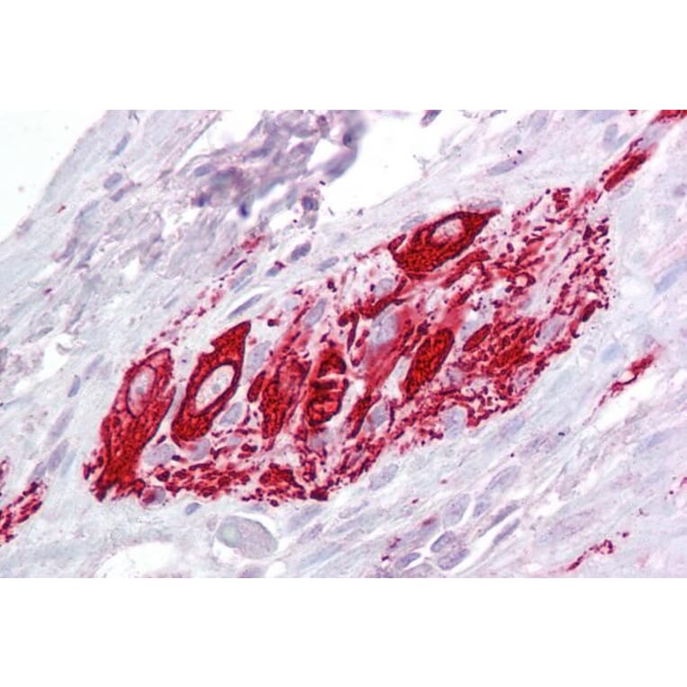 Immunohistochemistry - Anti-ITM2B Antibody (A84634) - Antibodies.com