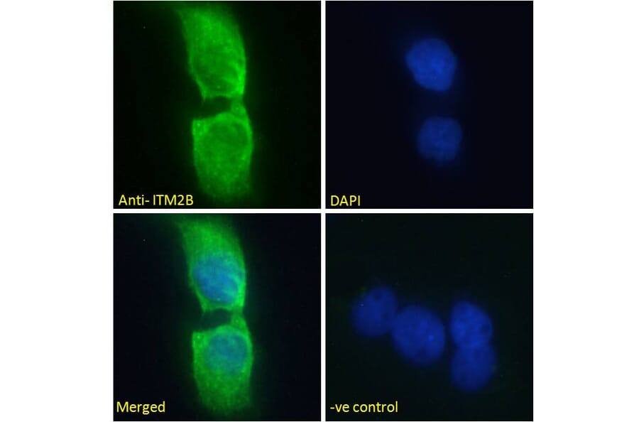 Immunofluorescence - Anti-ITM2B Antibody (A84634) - Antibodies.com