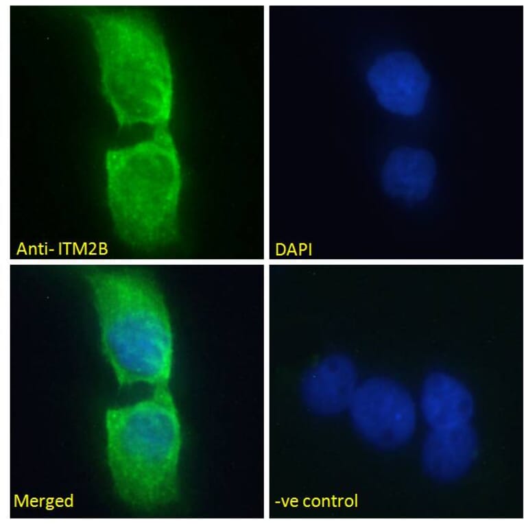 Immunofluorescence - Anti-ITM2B Antibody (A84634) - Antibodies.com