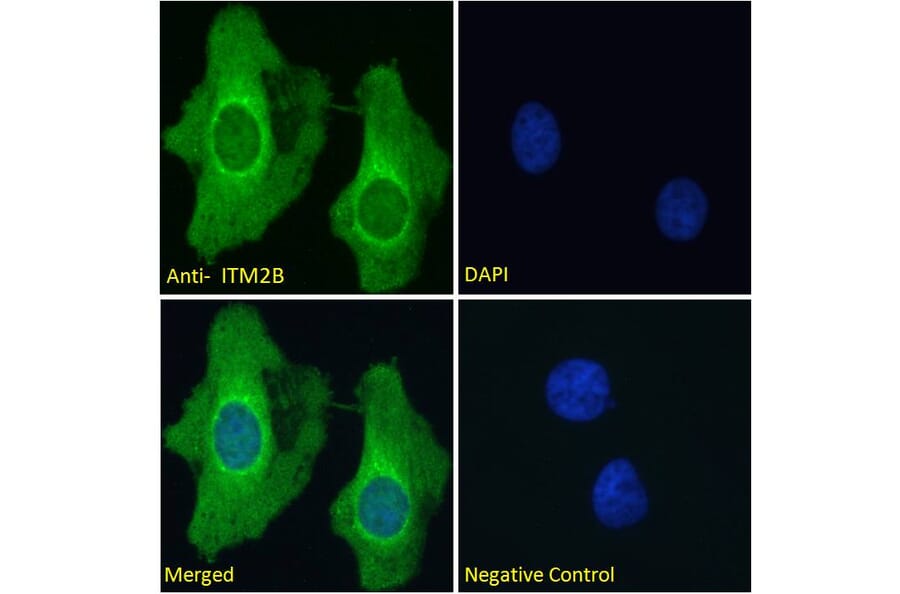 Immunofluorescence - Anti-ITM2B Antibody (A84634) - Antibodies.com