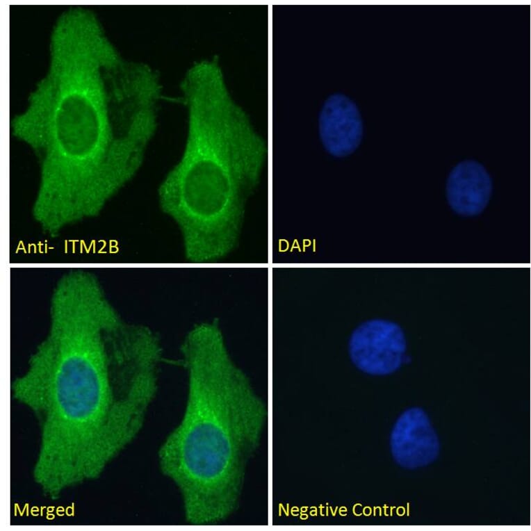 Immunofluorescence - Anti-ITM2B Antibody (A84634) - Antibodies.com