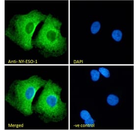 Immunofluorescence - Anti-CTAG1B Antibody (A84635) - Antibodies.com