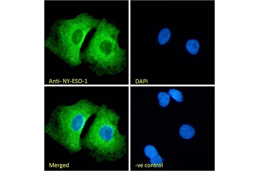 Immunofluorescence - Anti-CTAG1B Antibody (A84635) - Antibodies.com