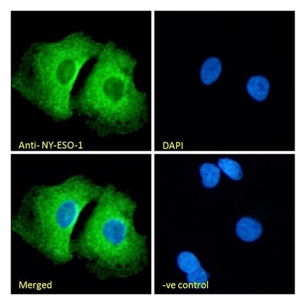 Immunofluorescence - Anti-CTAG1B Antibody (A84635) - Antibodies.com