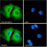 Immunofluorescence - Anti-CTAG1B Antibody (A84635) - Antibodies.com