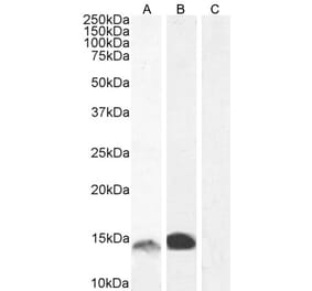 Western Blot - Anti-S100A9 Antibody (A84636) - Antibodies.com