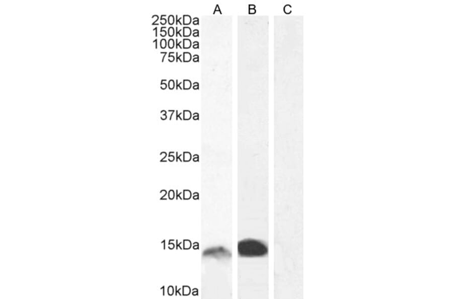 Western Blot - Anti-S100A9 Antibody (A84636) - Antibodies.com