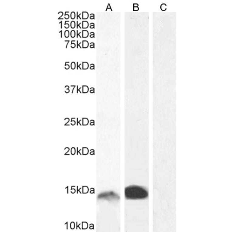 Western Blot - Anti-S100A9 Antibody (A84636) - Antibodies.com