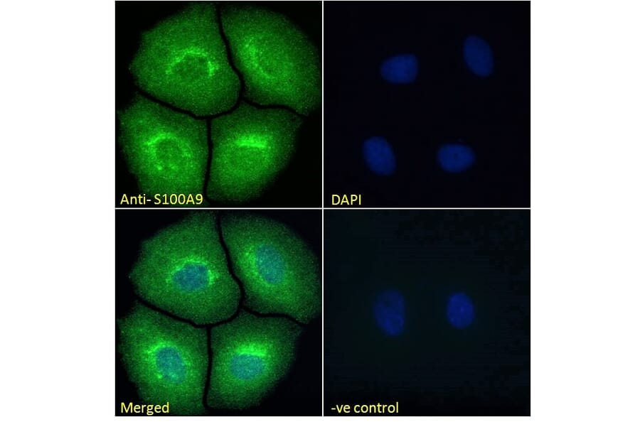 Immunofluorescence - Anti-S100A9 Antibody (A84636) - Antibodies.com