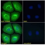 Immunofluorescence - Anti-S100A9 Antibody (A84636) - Antibodies.com