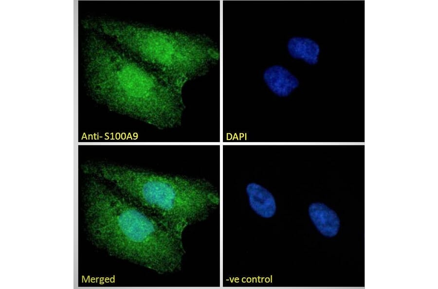 Immunofluorescence - Anti-S100A9 Antibody (A84636) - Antibodies.com