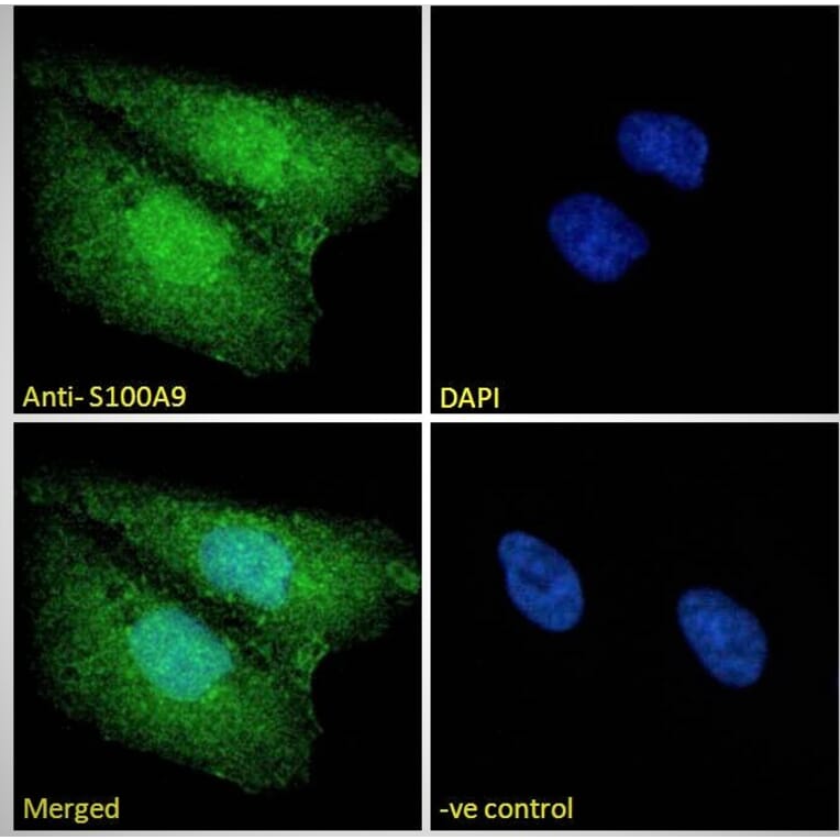 Immunofluorescence - Anti-S100A9 Antibody (A84636) - Antibodies.com