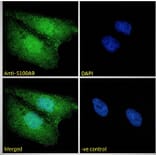 Immunofluorescence - Anti-S100A9 Antibody (A84636) - Antibodies.com