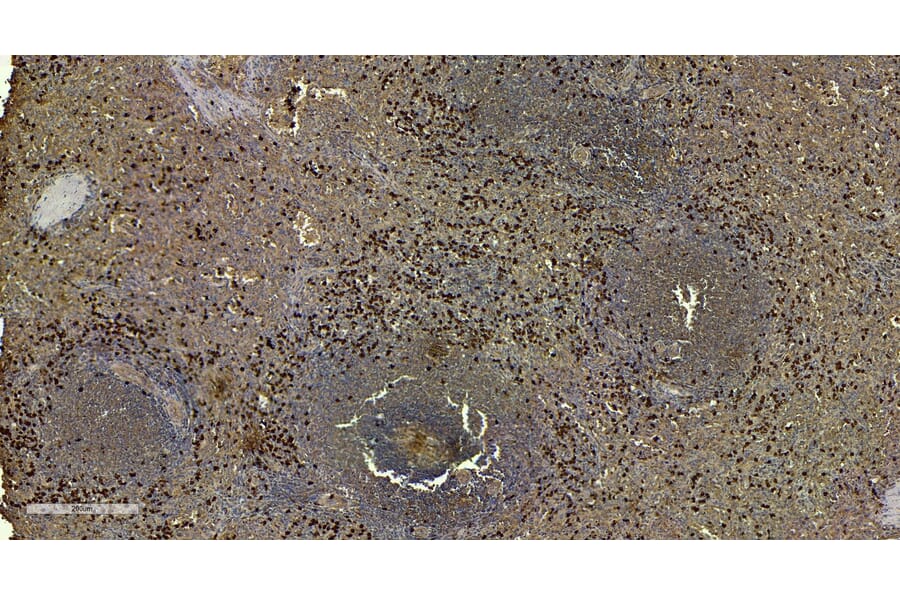 Immunohistochemistry - Anti-S100A9 Antibody (A84636) - Antibodies.com
