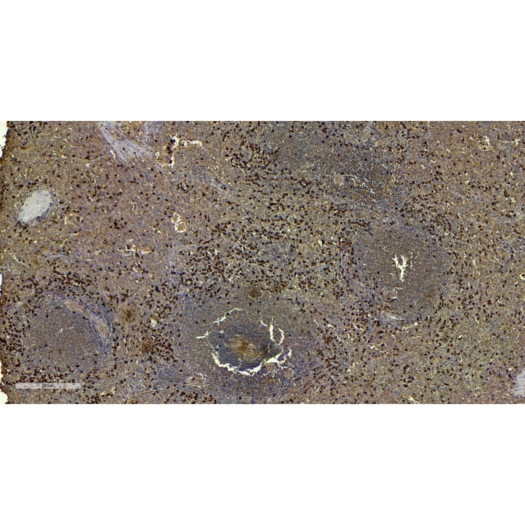 Immunohistochemistry - Anti-S100A9 Antibody (A84636) - Antibodies.com