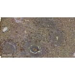 Immunohistochemistry - Anti-S100A9 Antibody (A84636) - Antibodies.com