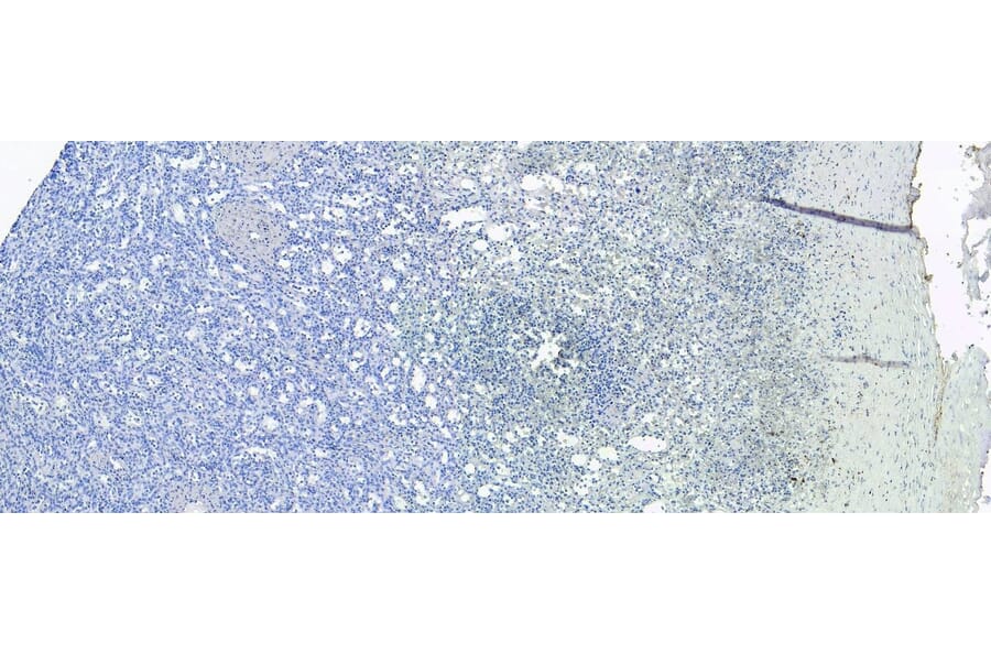 Immunohistochemistry - Anti-S100A9 Antibody (A84636) - Antibodies.com