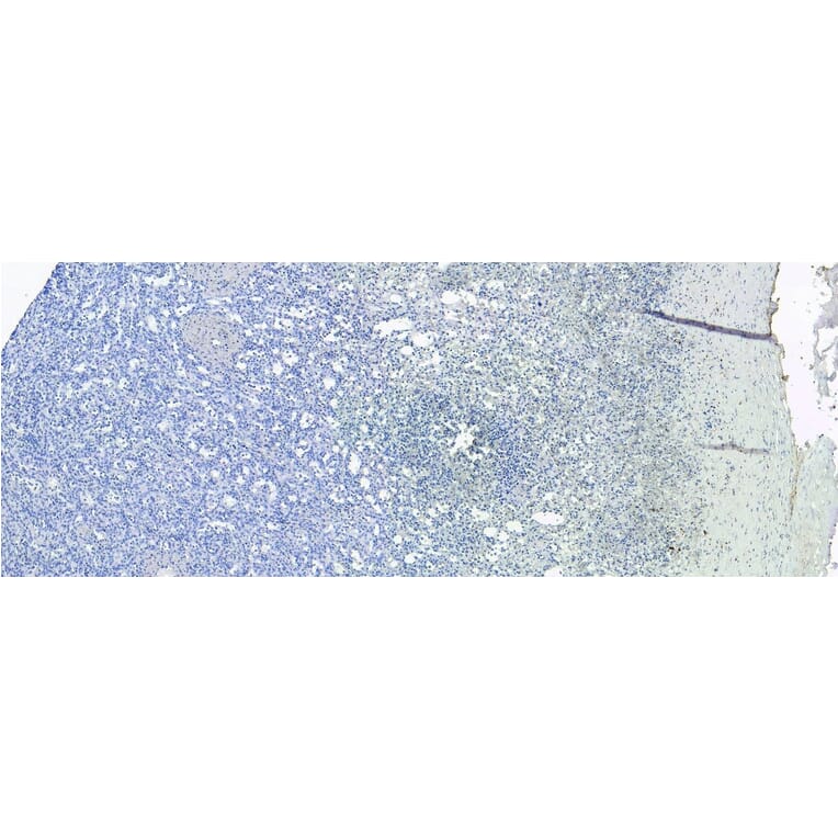 Immunohistochemistry - Anti-S100A9 Antibody (A84636) - Antibodies.com