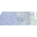 Immunohistochemistry - Anti-S100A9 Antibody (A84636) - Antibodies.com