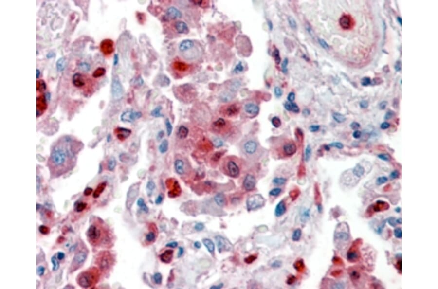 Immunohistochemistry - Anti-S100A9 Antibody (A84636) - Antibodies.com