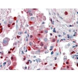 Immunohistochemistry - Anti-S100A9 Antibody (A84636) - Antibodies.com