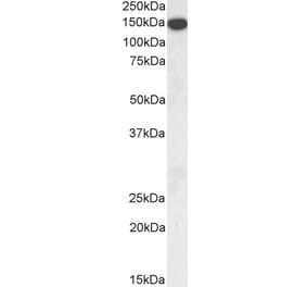 Western Blot - Anti-Thrombospondin Antibody (A84637) - Antibodies.com