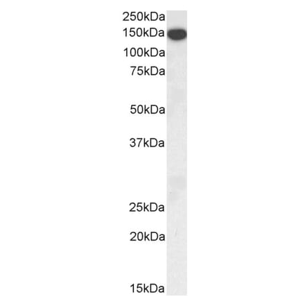 Western Blot - Anti-Thrombospondin Antibody (A84637) - Antibodies.com