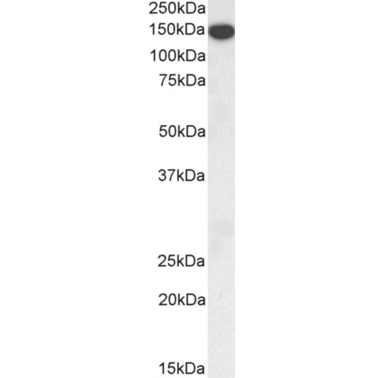 Western Blot - Anti-Thrombospondin Antibody (A84637) - Antibodies.com