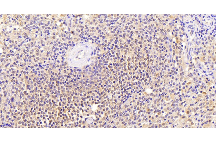 Immunohistochemistry - Anti-Thrombospondin Antibody (A84637) - Antibodies.com