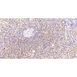 Immunohistochemistry - Anti-Thrombospondin Antibody (A84637) - Antibodies.com